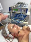 b065-mezoterapia-biolifting-szolnok-szep-kartya.jpg